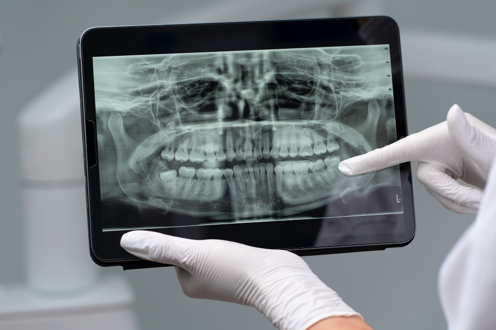 Digital X-Rays in Sugar Land