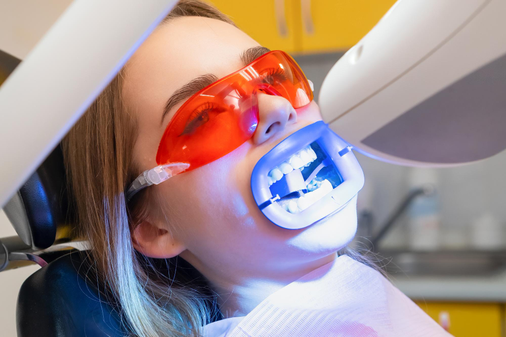 Teeth Whitening in Sugar Land